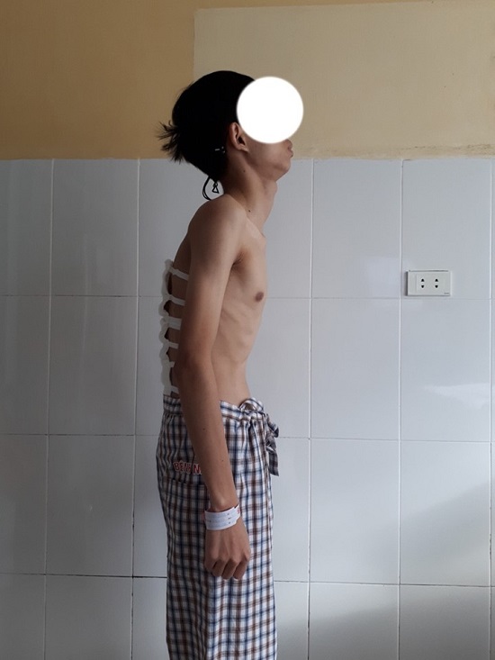 Bệnh nhân đã được cải thiện cuộc sống sau phẫu thuật.