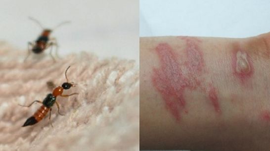 Cảnh báo tình trạng kiến ba khoang tấn công