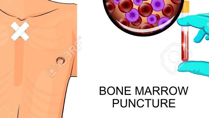 Bone puncture
