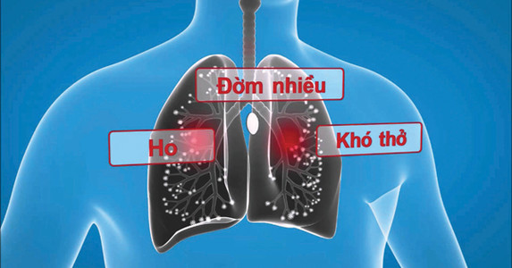 Phòng bệnh viêm phế quản mãn tính