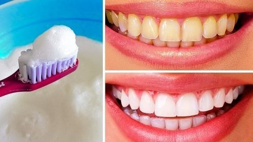 8 mẹo đơn giản làm trắng răng, không ê buốt ngay tại nhà