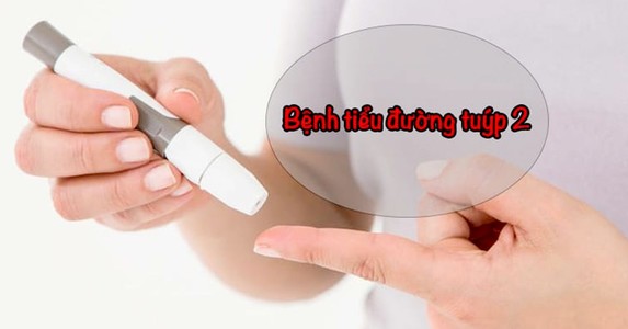 Có phòng tránh được bệnh đái tháo đường type 2?