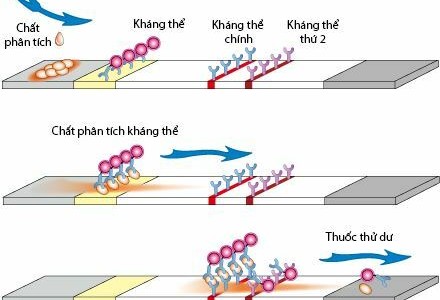 Que test HIV bị cắt sẽ làm sai lệch kết quả xét nghiệm