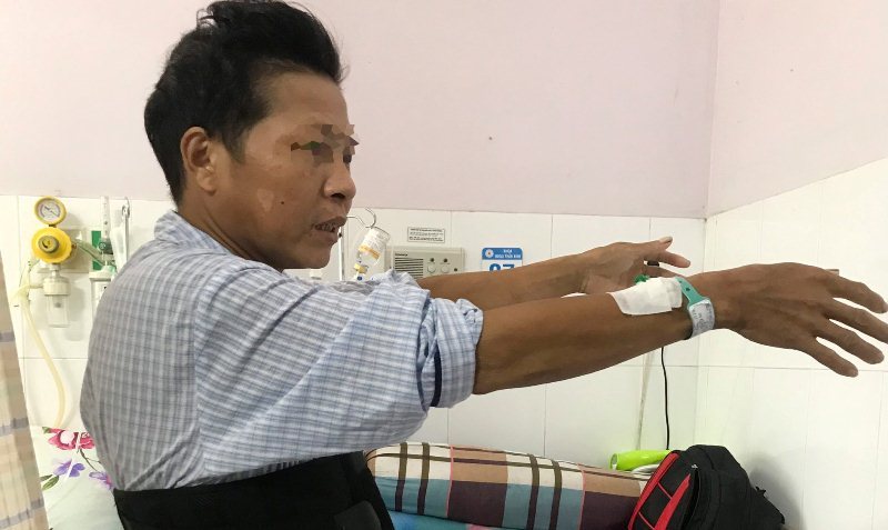 Bệnh nhân được phẫu thuật cố định cột sống đã có thể vận động và đi lại được. Ảnh: BSCC