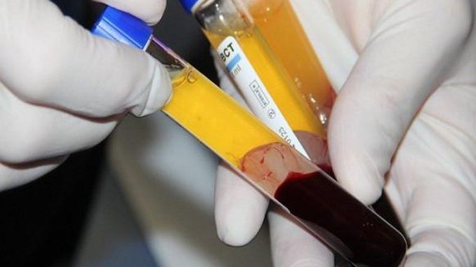 Không xét nghiệm nCoV dịch vụ