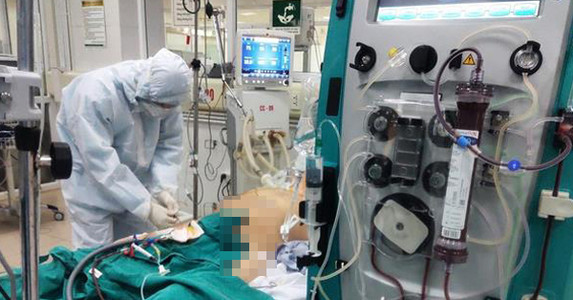 Việt Nam nằm trong 2 nước chưa có ca Covid-19 tử vong dù có bệnh nhân nặng