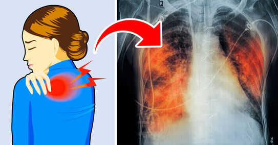 Có 5 dấu hiệu này chứng tỏ phổi của bạn đang "kêu cứu", tuyệt đối không được chủ quan