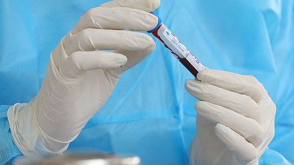 Covid-19: Số ca nhiễm lên 270
