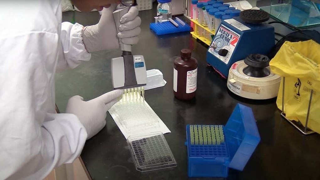 Phát hiện 5 kháng thể chống được nCoV