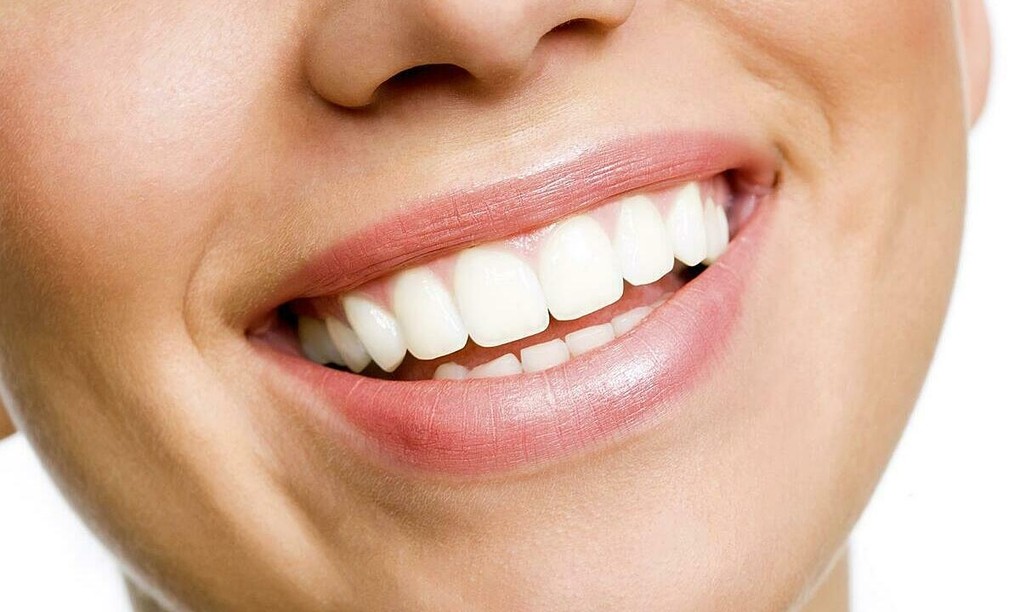 Cách làm trắng răng không cần bác sĩ nha khoa