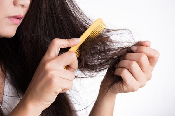Rụng tóc nhiều có nguy hiểm?