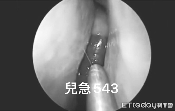 Rửa mặt bằng nước suối trên đường đi, cậu bé chảy máu cam liên tục vì con vật này bên trong
