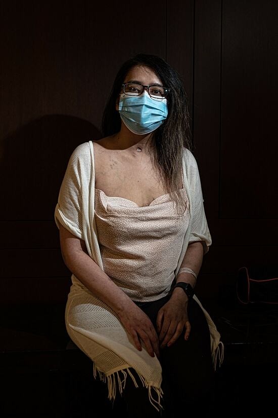 Mayra Ramirez chụp ảnh sau khi thực hiện ca ghép phổi, tháng 7. Ảnh: NY Times
