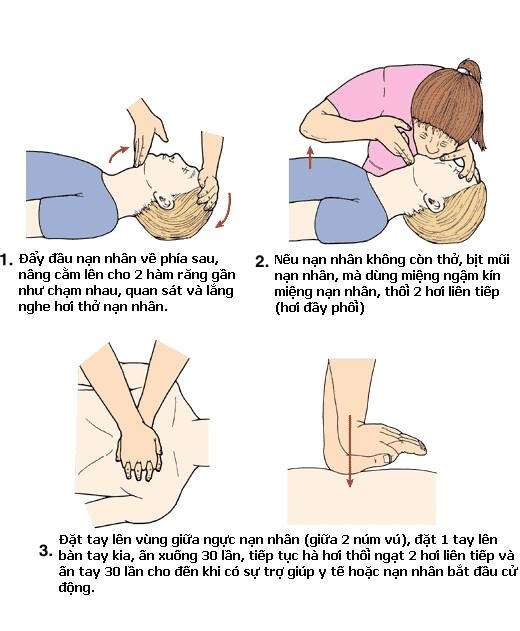 Các bước hà hơi thổi ngạt và bóp tim ngoài lồng ngực. Ảnh: suckhoedoisong.