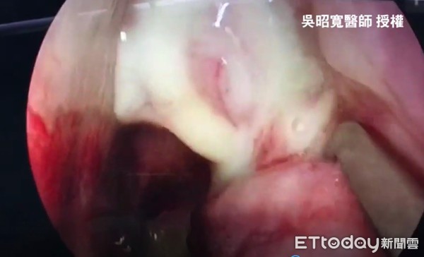 Sau khi hôn, bạn trai sốc nặng khi thấy thứ này trong miệng bạn gái