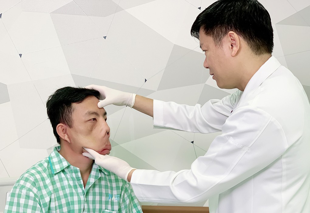 Gương mặt bệnh nhân Mến thon gọn 50% sau mổ lần một. Ảnh: Hải Đăng.