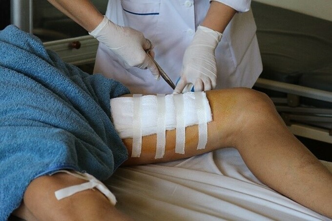 Bị đứt cơ đùi vì mảnh vỡ bình rượu