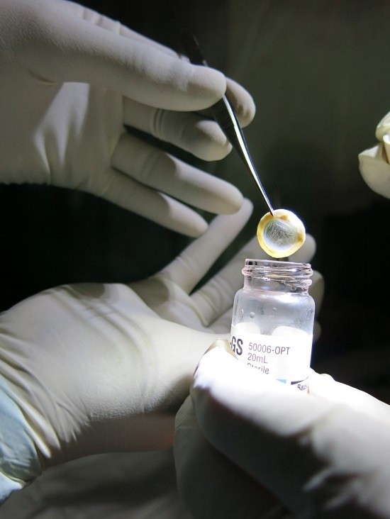 Giác mạc được lấy từ người đã mất. Ảnh: Nhân vật cung cấp