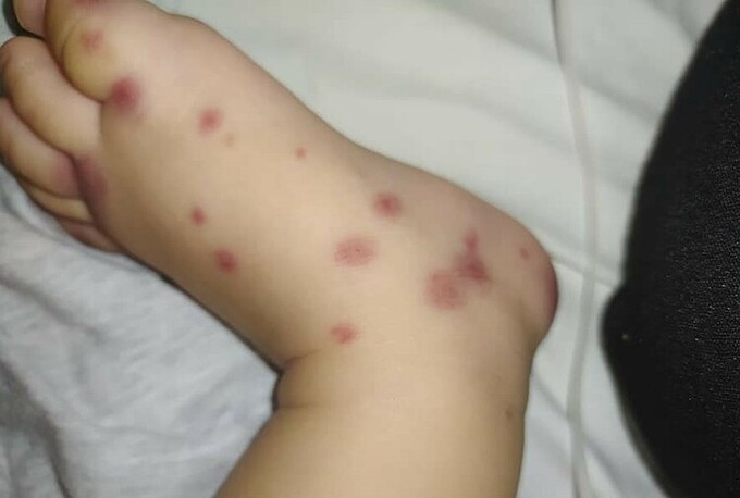 Em bé mắc bệnh cực hiếm