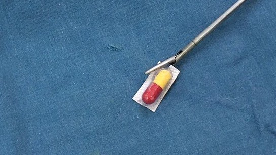 Bé trai rách thực quản vì uống thuốc nguyên vỉ