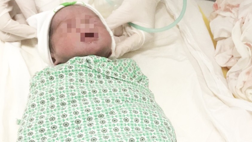 Mang song thai, một thai sảy, một bé chào đời sau 2 tháng