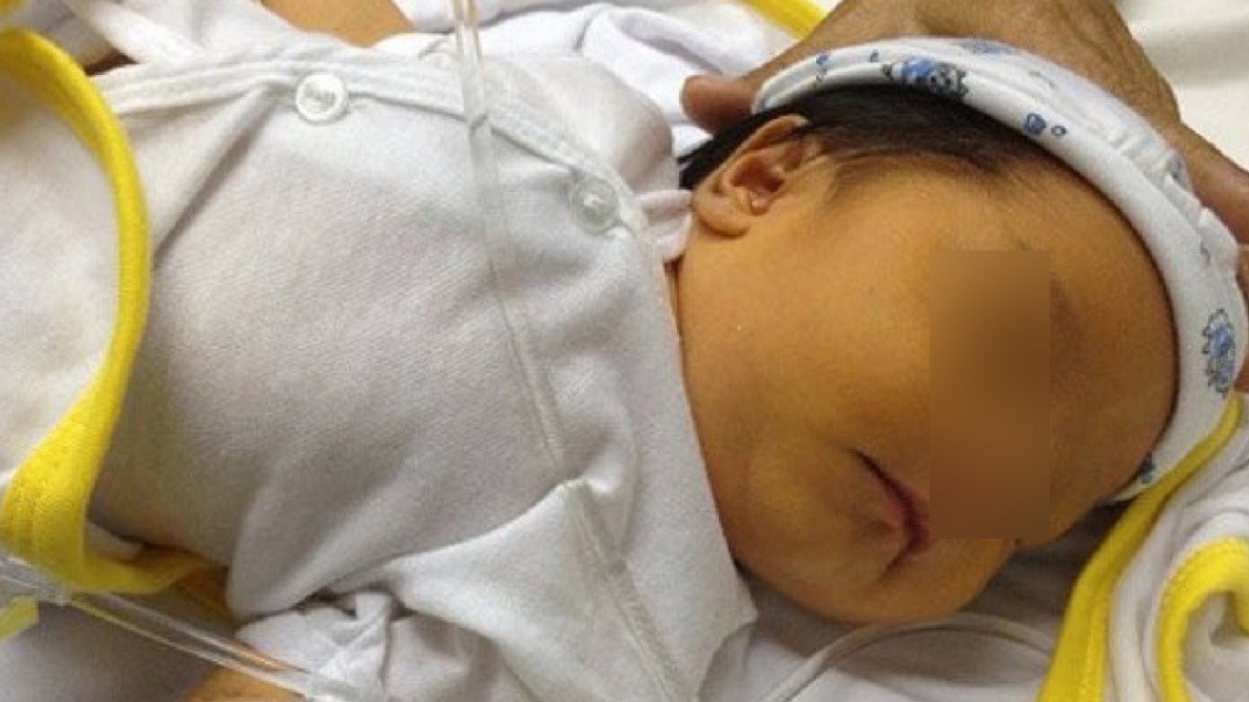 Sinh con đứa mất khi vừa chào đời, đứa bại não, mẹ bất ngờ khi biết lý do