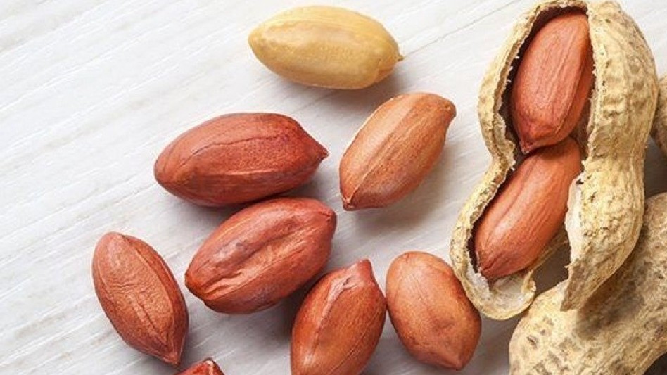 Phát hiện hạt lạc trong phế quản bé 18 tháng tuổi sau cơn thở rít bất thường