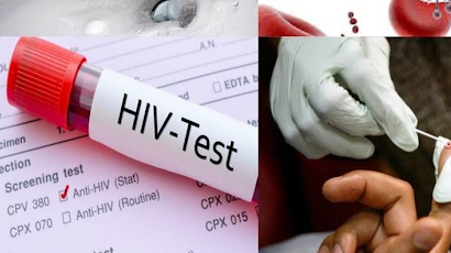 Xử trí khi bị phơi nhiễm HIV