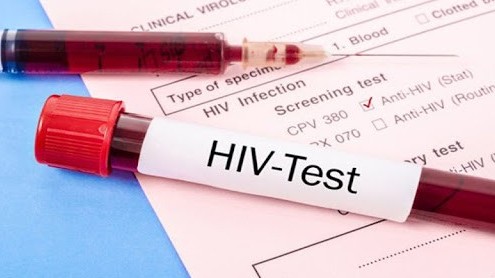 Bị nhiễm HIV mà không biết