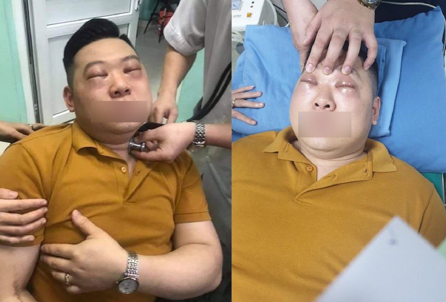 Bệnh nhân thời điểm nhập viện Đa khoa Hùng Vương, Phú Thọ cấp cứu - Ảnh: BVCC
