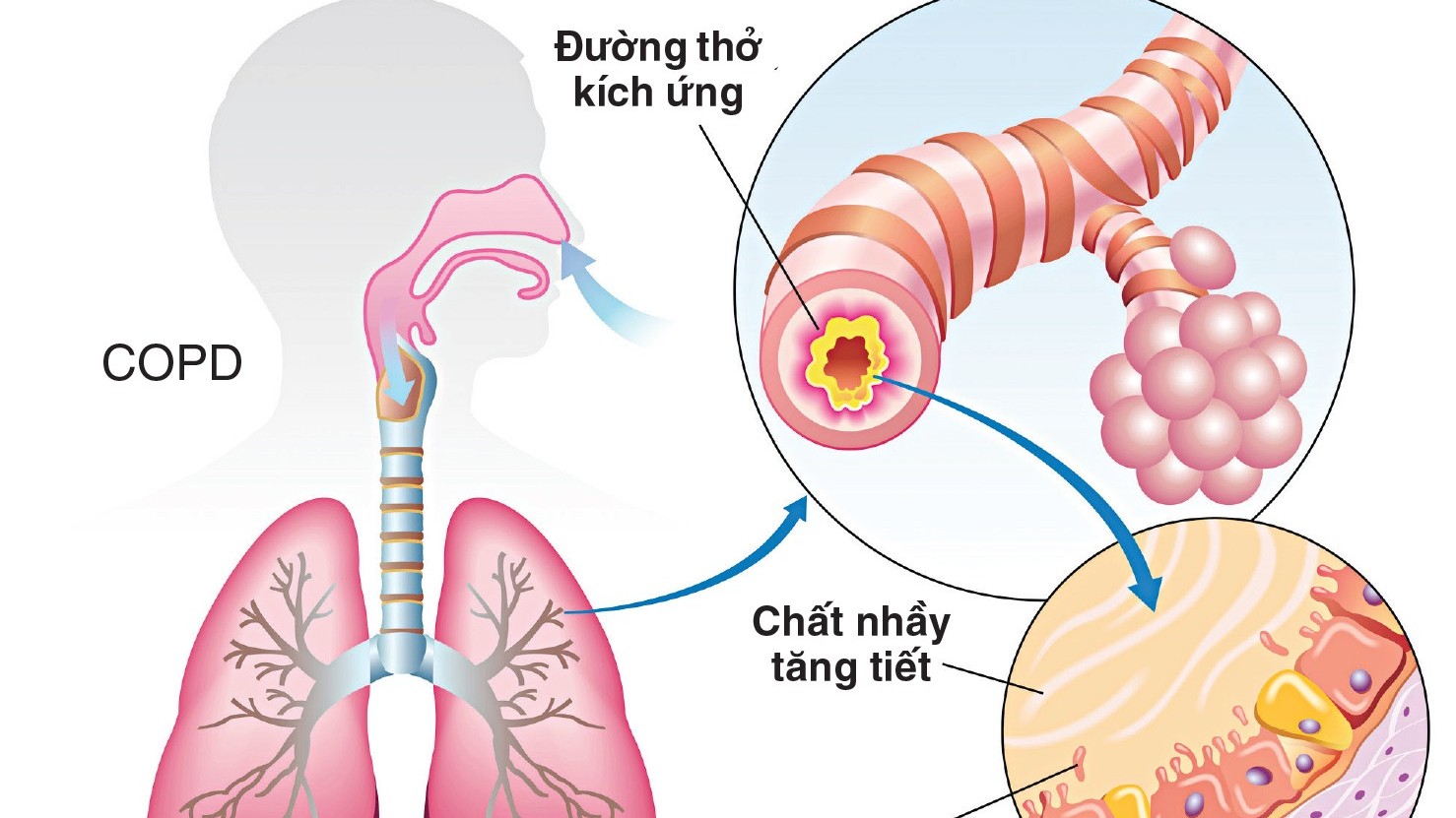 Thuốc long đờm dùng sao cho đúng