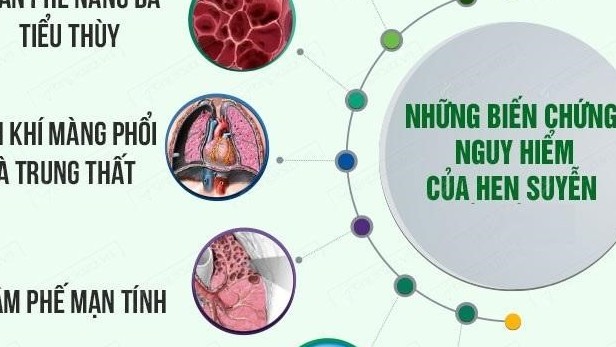 Hỗ trợ 50 bệnh viện và trung tâm y tế điều trị bệnh lý hen, phổi