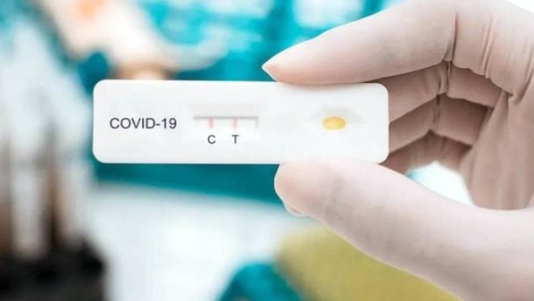 Cần sớm bình ổn giá kit test nhanh Covid-19