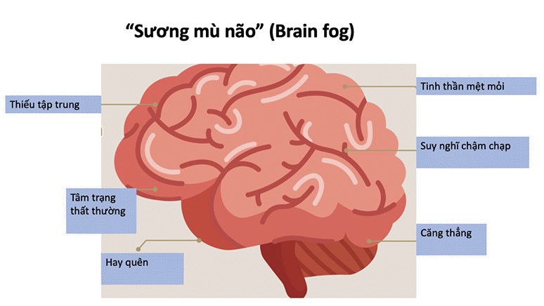 Học kém tập trung, hay quên… có thể mắc sương mù não hậu Covid-19