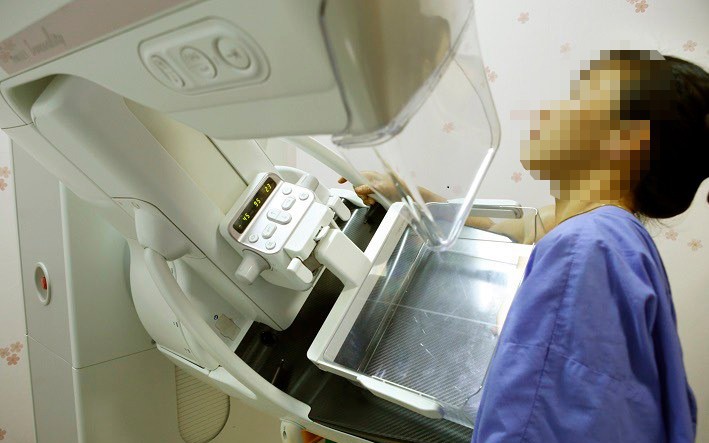 Bệnh nhân được chụp X-quang tầm soát ung thư.