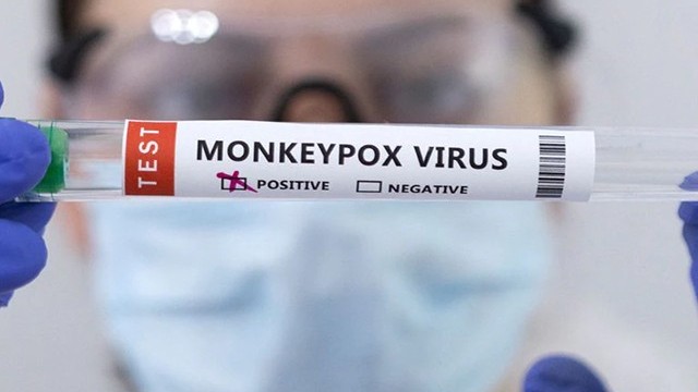 Cách xác định trường hợp nghi ngờ nhiễm bệnh đậu mùa khỉ