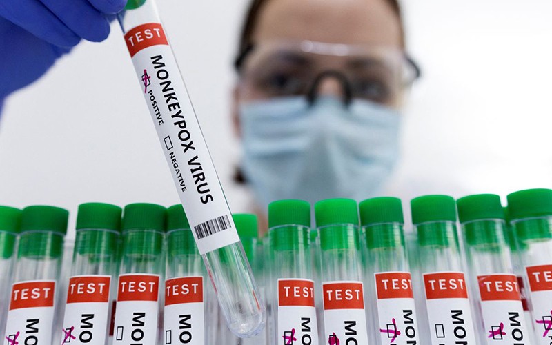 Một số thông tin và khuyến cáo liên quan bệnh đậu mùa khỉ