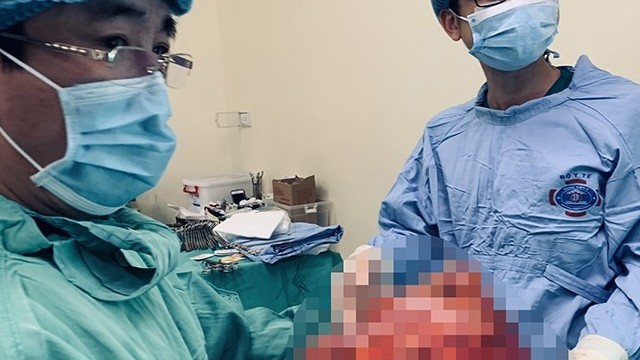Khối u có kích thước khủng 40cm.