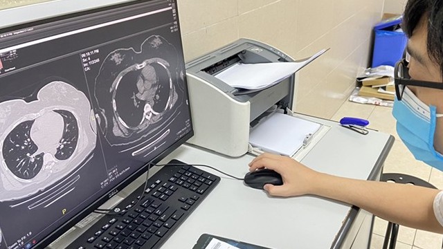 68% bệnh nhân có triệu chứng hậu Covid-19 kéo dài từ 2-5 tháng