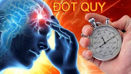 Ai có nguy cơ đột quỵ não cao?