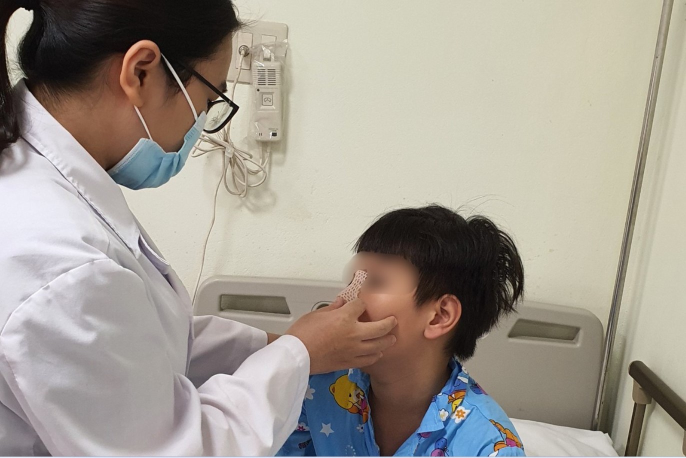 Xem bạn chơi "đồ long đao", bé trai bị vỡ mũi