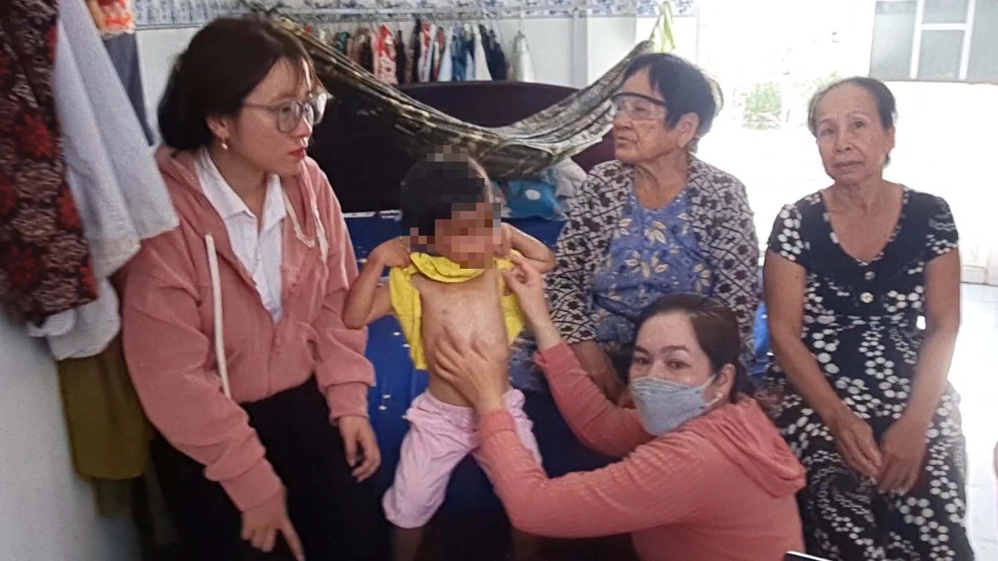 Thăm hỏi, hỗ trợ bé gái 4 tuổi nghi bị cha nuôi đánh đập ở Cà Mau