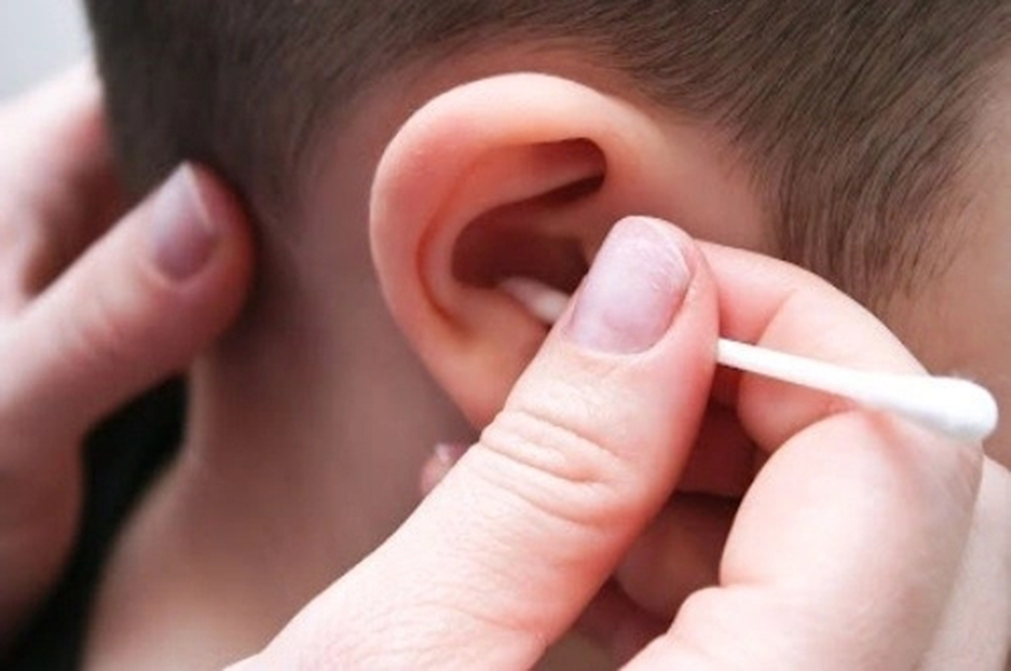 Có nên lấy ráy tai thường xuyên cho trẻ?